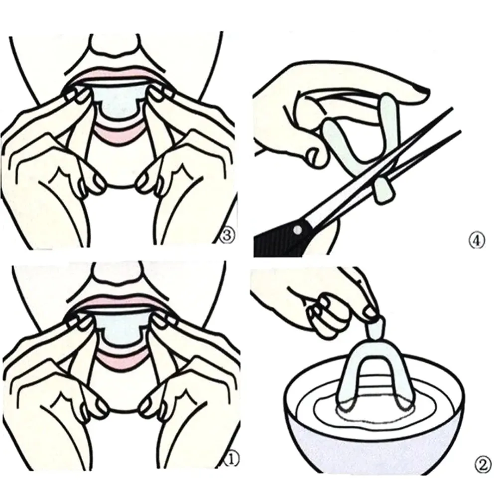 Anti-Snoring Mouth Guard Set