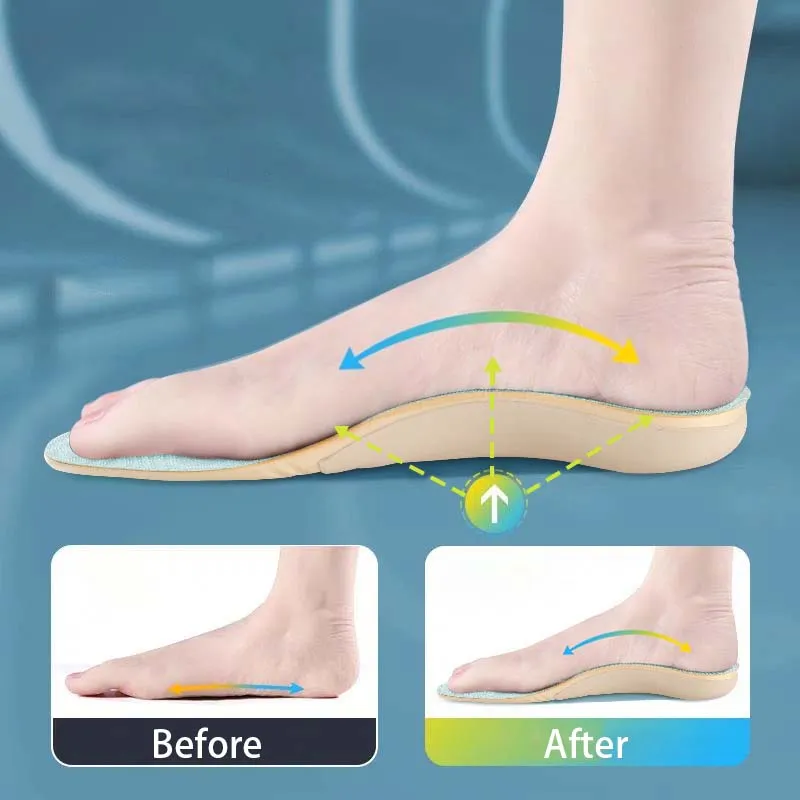 Dbeck® Shock Absorbing Orthotic Insoles for Flat Feet and Arch Support(🎁1 1FREE🎁)